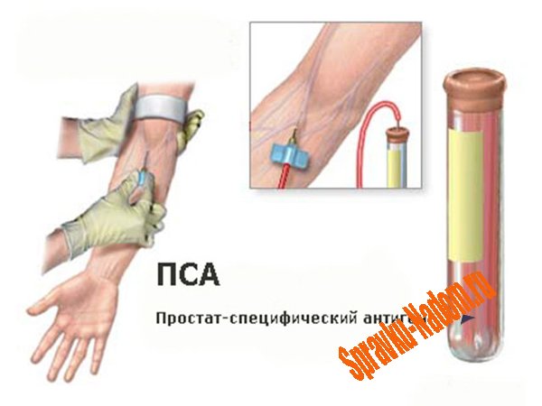 анализ крови , сдать